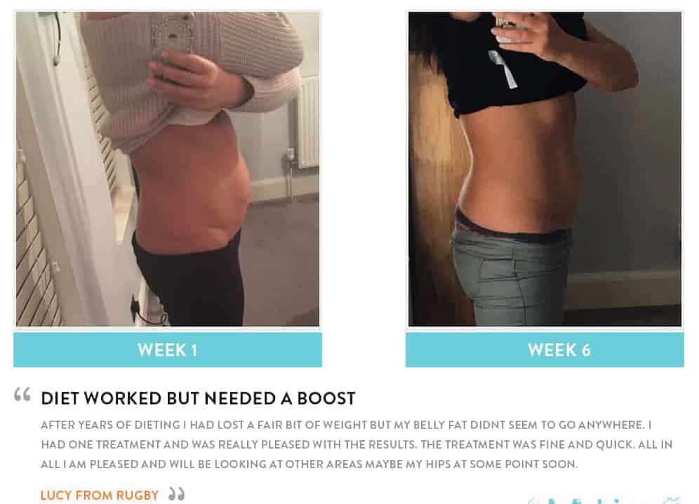 Before and After Dieting Lichfield