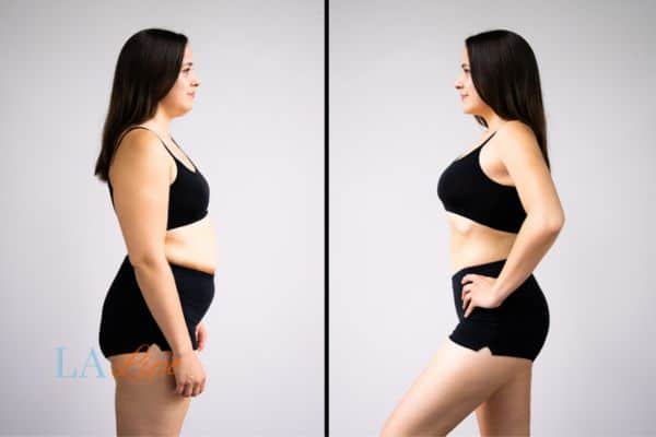 LA-EMS Body Sculpting