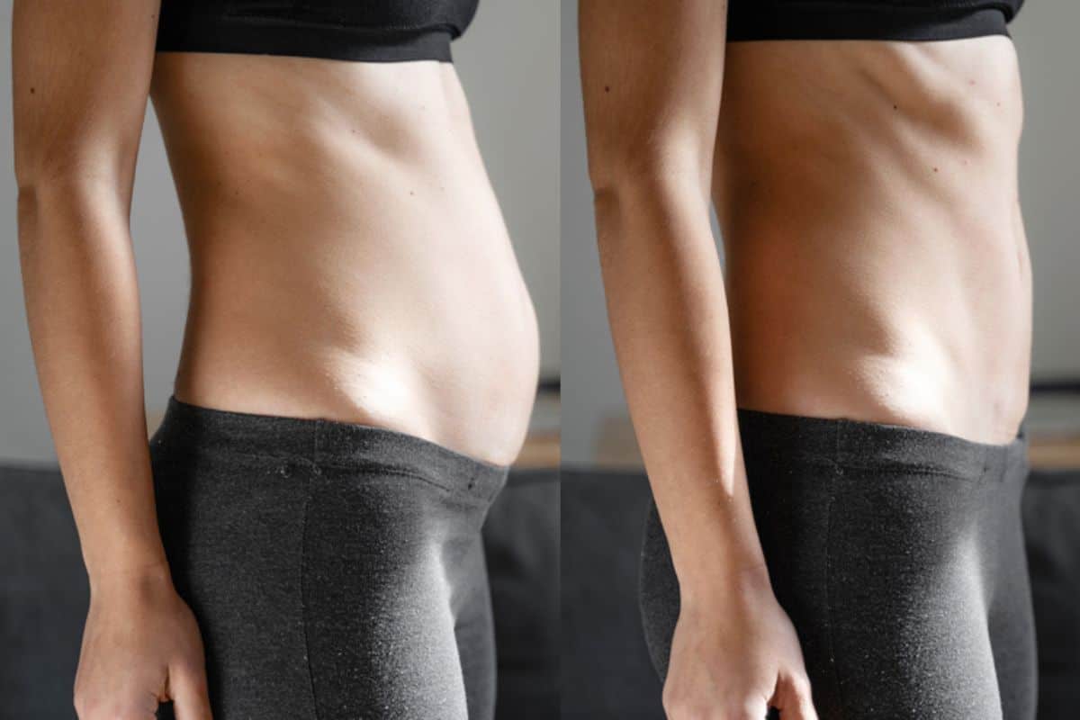 Post-Pregnancy: What Happens to Your Abdominal Muscles After Birth Lichfield