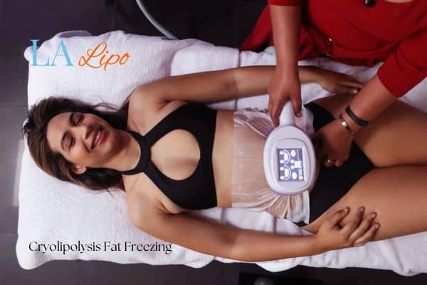 woman getting cryolipolysis Lichfield