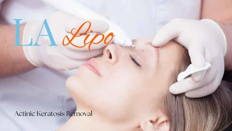 Woman receiving Actinic Keratosis Removal Treatment Lichfield