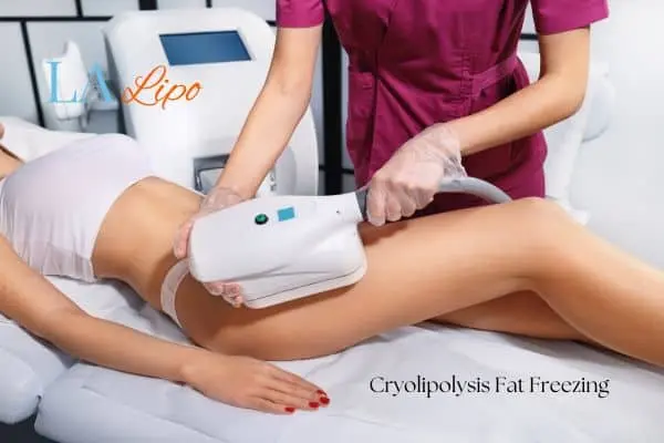 Woman receiving coolsculpting Lichfield treatment on her thighs