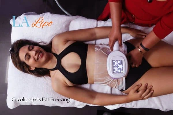 woman getting cryolipolysis Lichfield