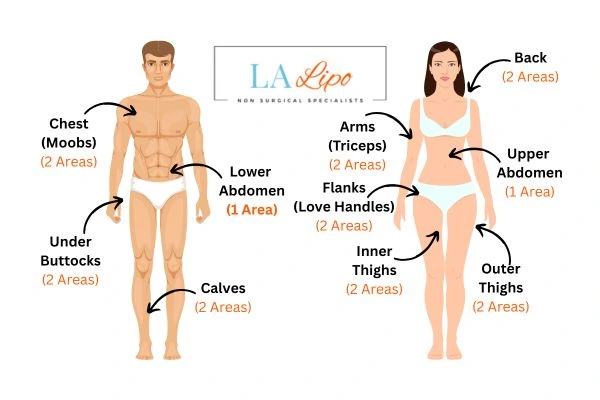 LA LIPO Cryolipolysis Areas Lichfield