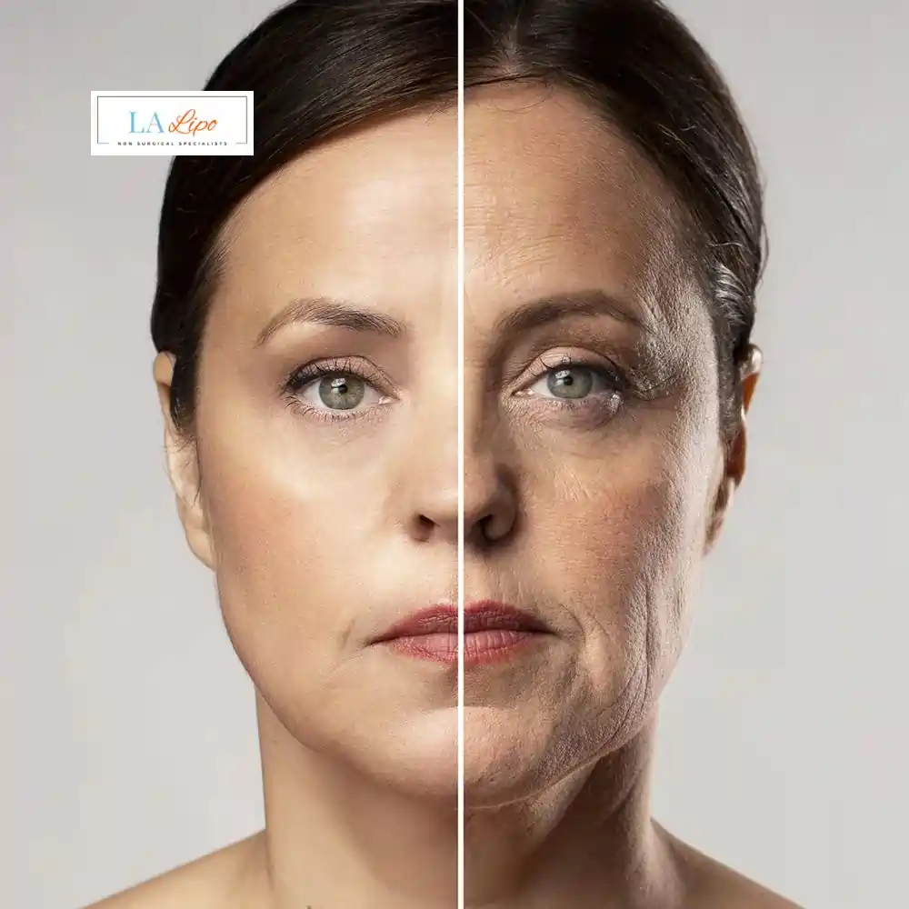 How Can You Tell If Non-Surgical Skin Tightening Is Right for You Lichfield?