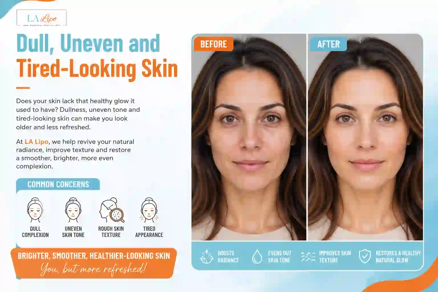 Sign #5: Dull, Uneven and Tired-Looking Skin Lichfield