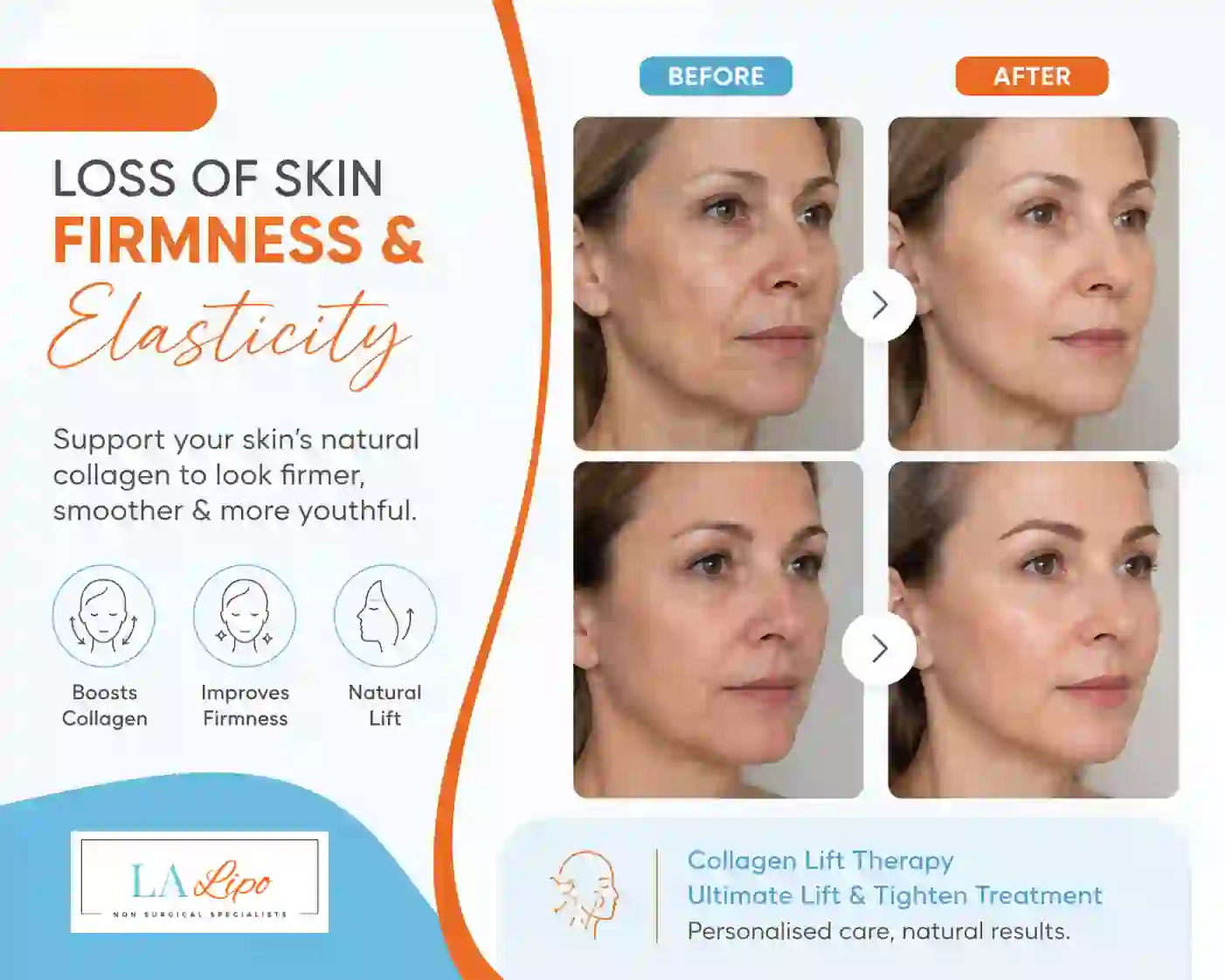 Sign #7: Loss of Skin Firmness and Elasticity Lichfield