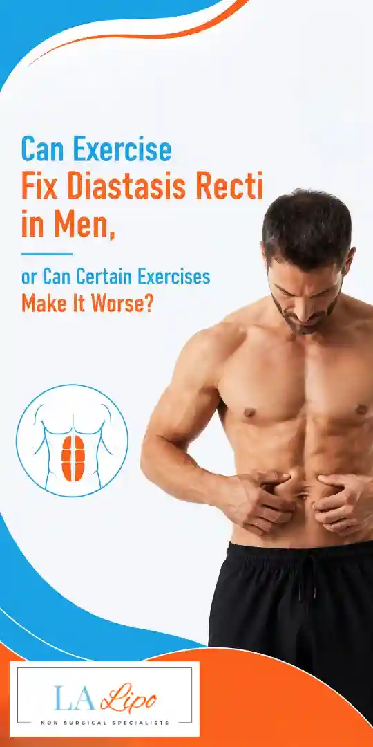 Can Exercise Fix Diastasis Recti in Men, or Can Certain Exercises Make It Worse Lichfield?