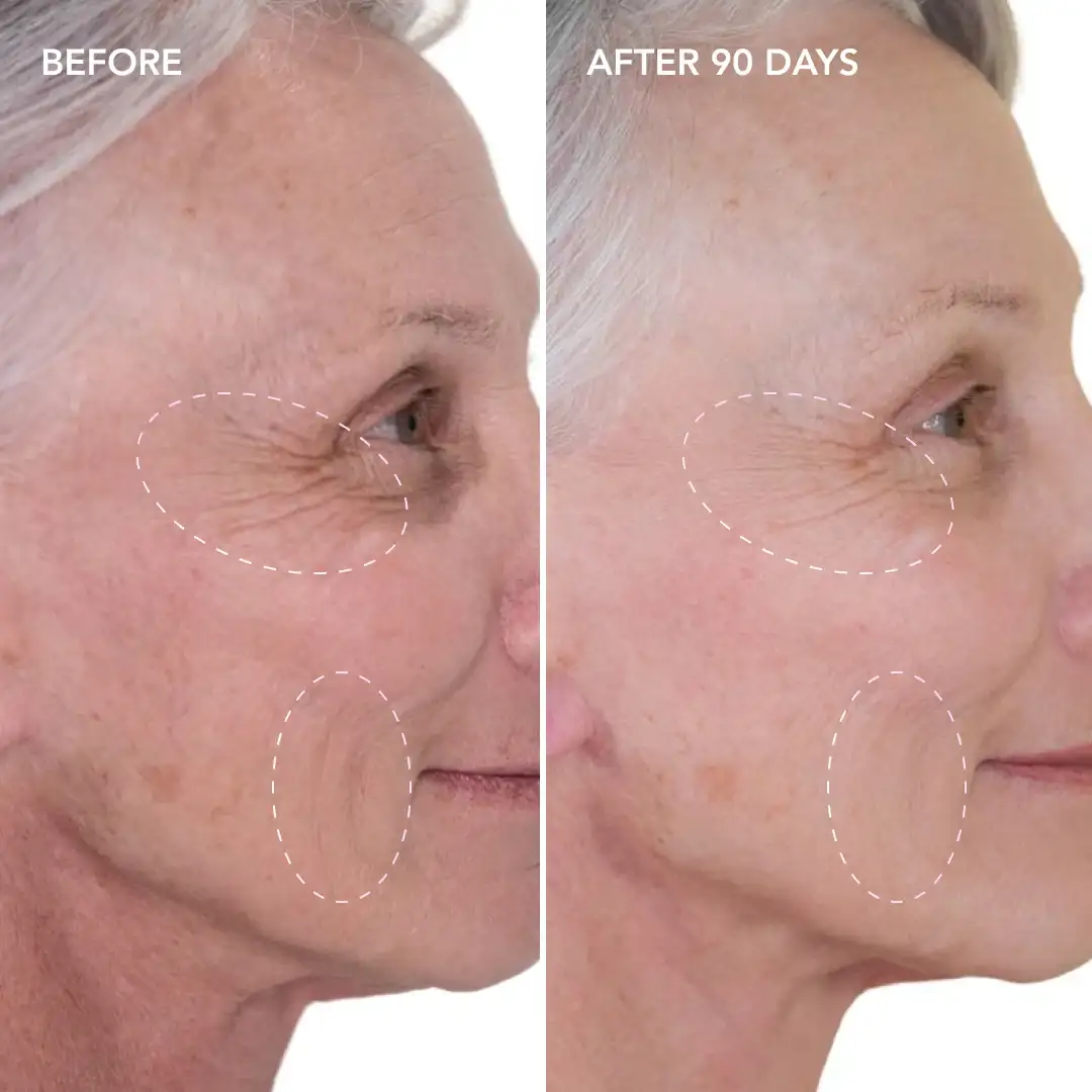 When will you see results Lichfield